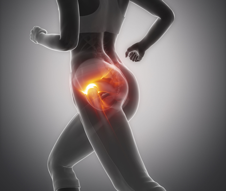 PIRIFORMIS STRETCHES TO RELIEVE PIRIFORMIS SYNDROME: