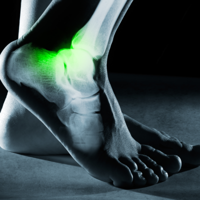 Gray Institute Foot and Ankle