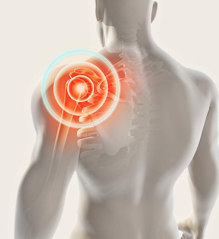 Shoulder Pain visual